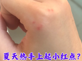 为什么发短信有红点